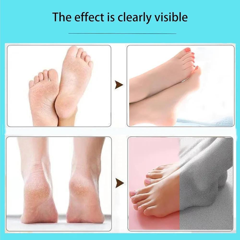 Electric Foot File Callus Remover